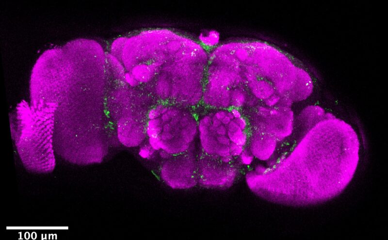Molecular observations by UC Santa Cruz scientists demystify parasitic mind control
